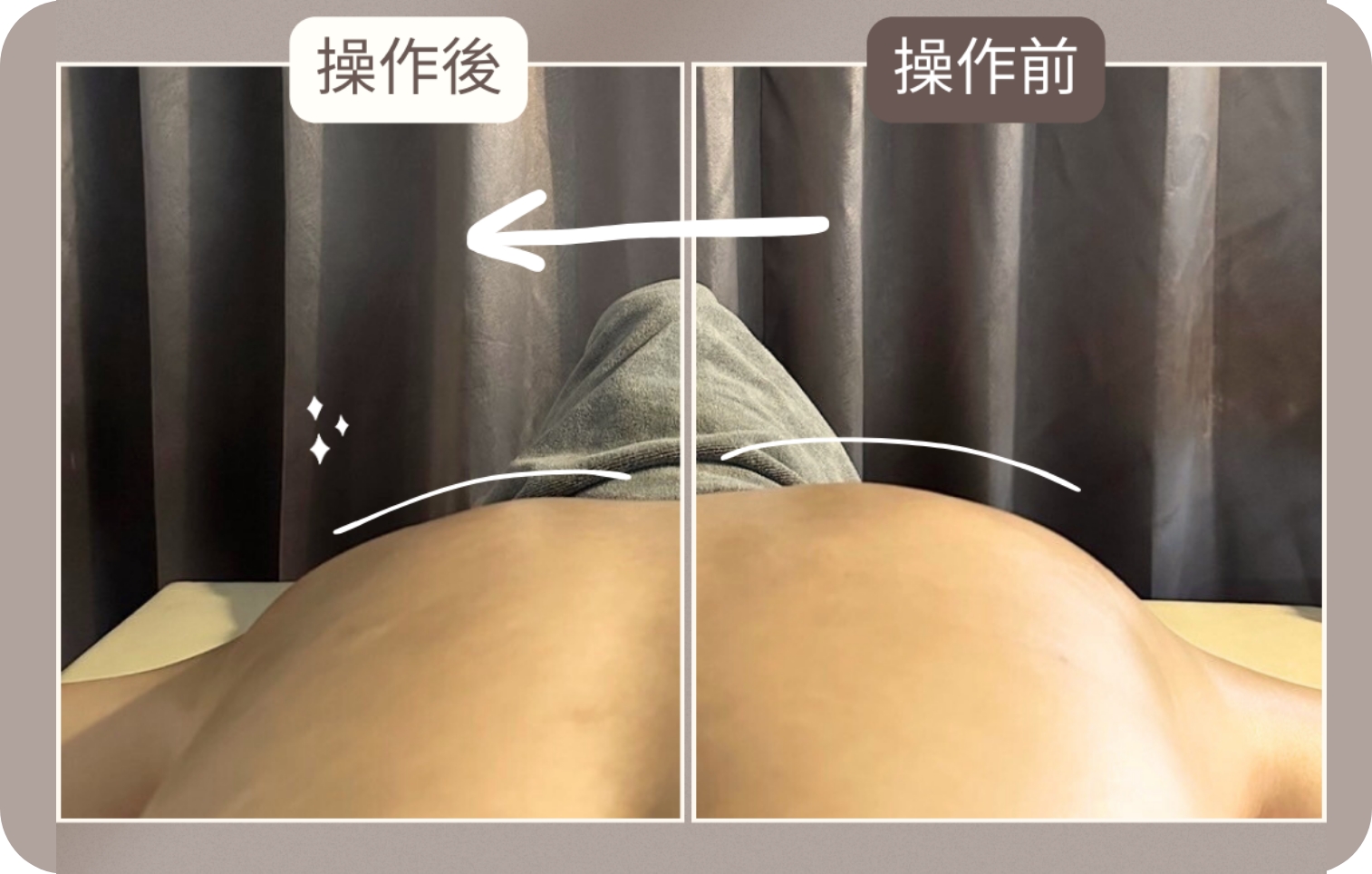 DFP實作對比照